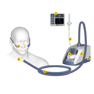 AIRVO: Heated High-Flow Nasal Oxygen Delivery System 