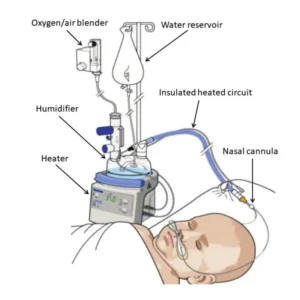 Neonatal Nasal High-Flow Oxygen Therapy